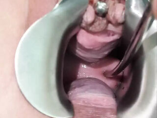 Milf Julie plays with her cervix